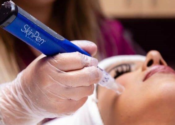 Skinpen